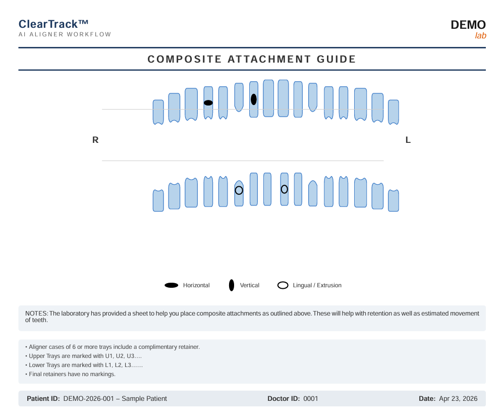Composite Attachment Guide